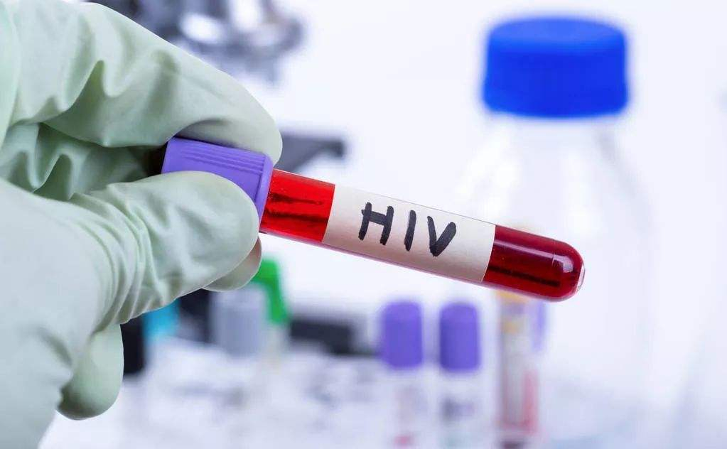 艾滋HIV确诊/确证实验，免疫印迹法（蛋白条带/蛋白膜条法）